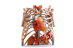 White Clouds 3D medical model